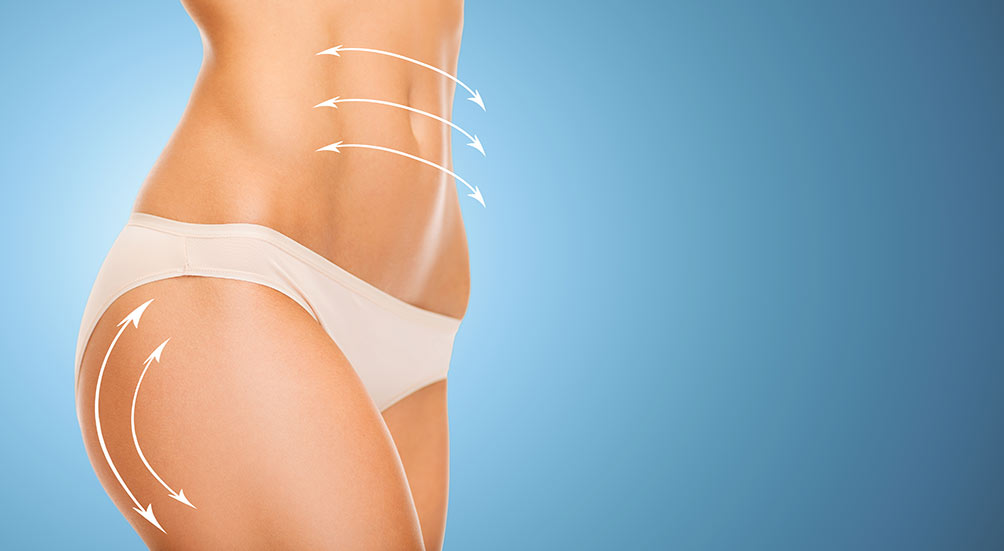 Tampa Liposuction Specialty Clinic