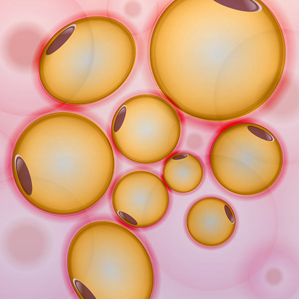 Depiction of fat cells that are variable in size
