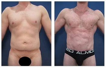 optimized chest 34 YO front Optimized chest 34 YO front