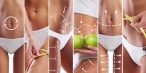 Liposuction Experience visual representation