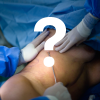 Answering all of your Liposuction Questions is critical to building rapport with your surgeon.