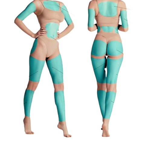 A woman's body is shown in two different poses with hypothetic areas to undergo liposuction