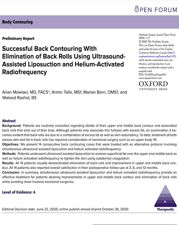 Successful Back Contouring with elimination of back rolls usign ultrasound assisted liposuction and subdermal radiofrequency