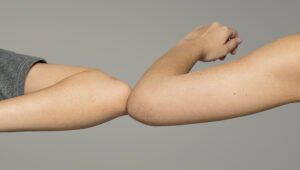 Liposuction arm before and after